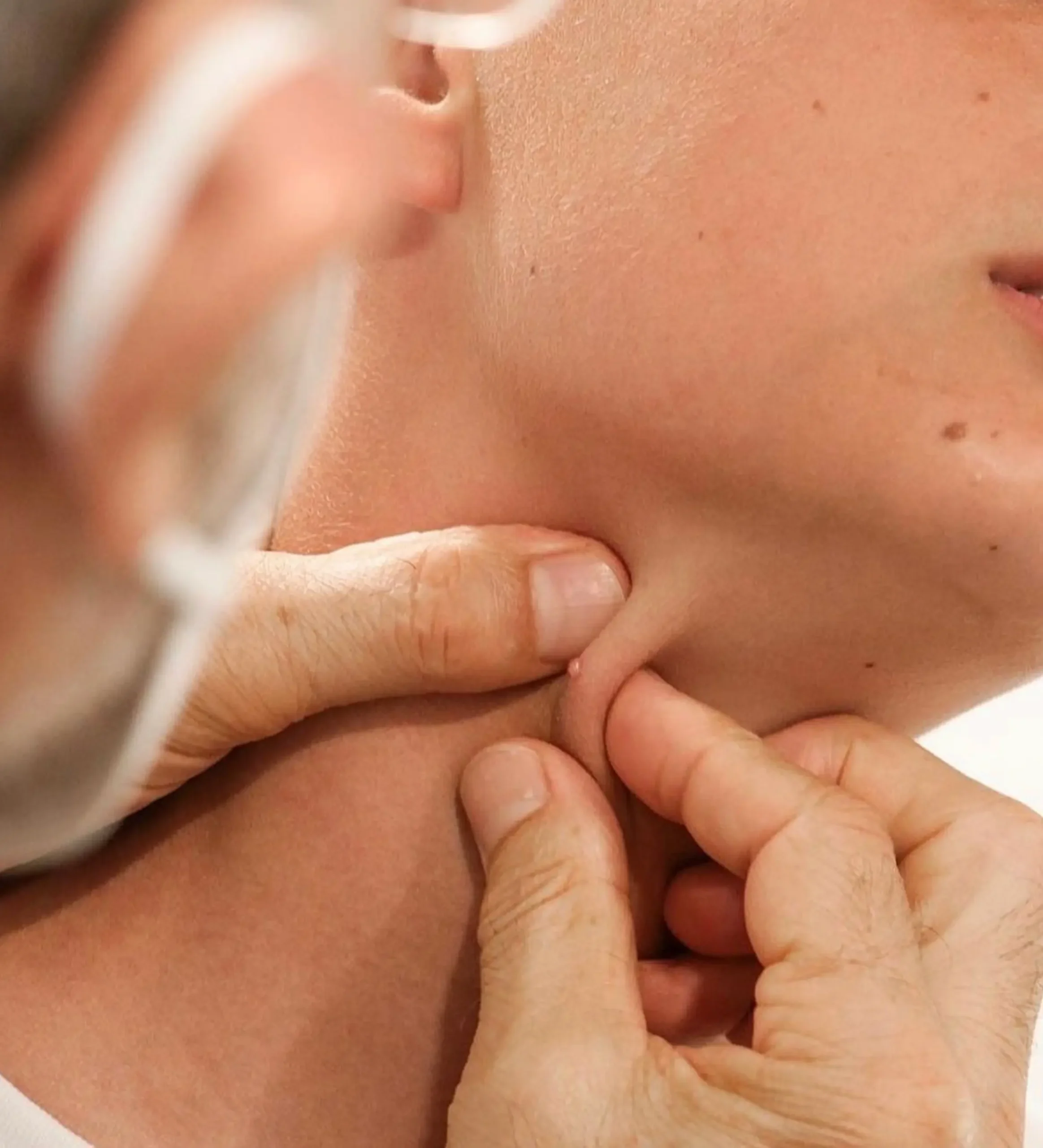 cicatrices quemaduras